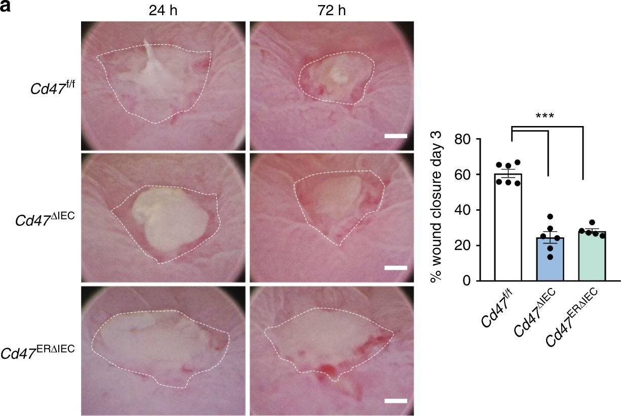 Detection of Mouse CD47 by Immunohistochemistry