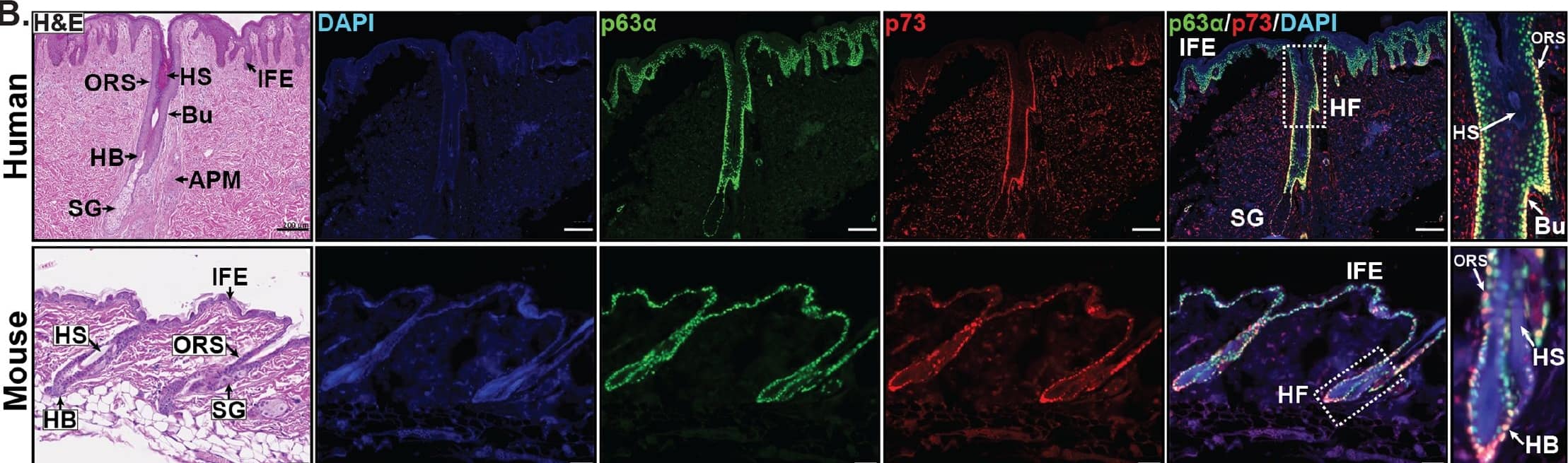 Detection of Mouse p63/TP73L by Immunocytochemistry/Immunofluorescence