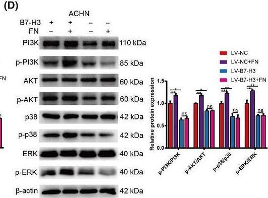 Detection of Fibronectin by Western Blot