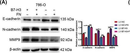 Detection of Fibronectin by Western Blot
