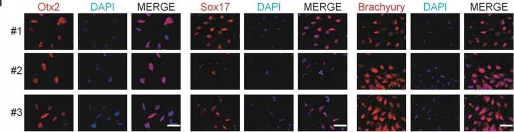 Detection of Human SOX17 by Immunocytochemistry/Immunofluorescence.