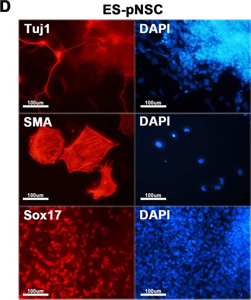 Detection of Mouse Human SOX17 Antibody by Immunocytochemistry/ Immunofluorescence
