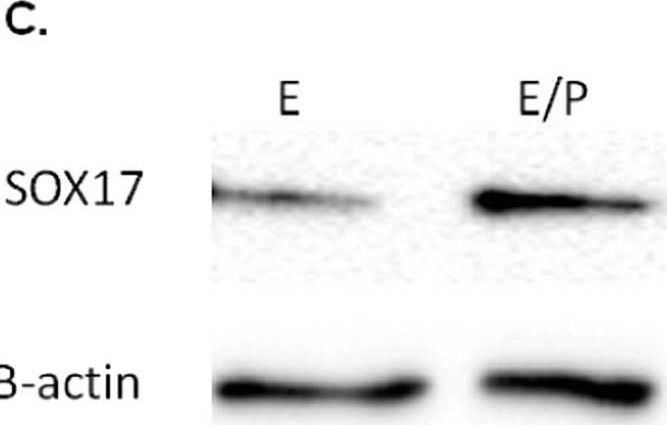 Detection of Human Human SOX17 Antibody by Western Blot