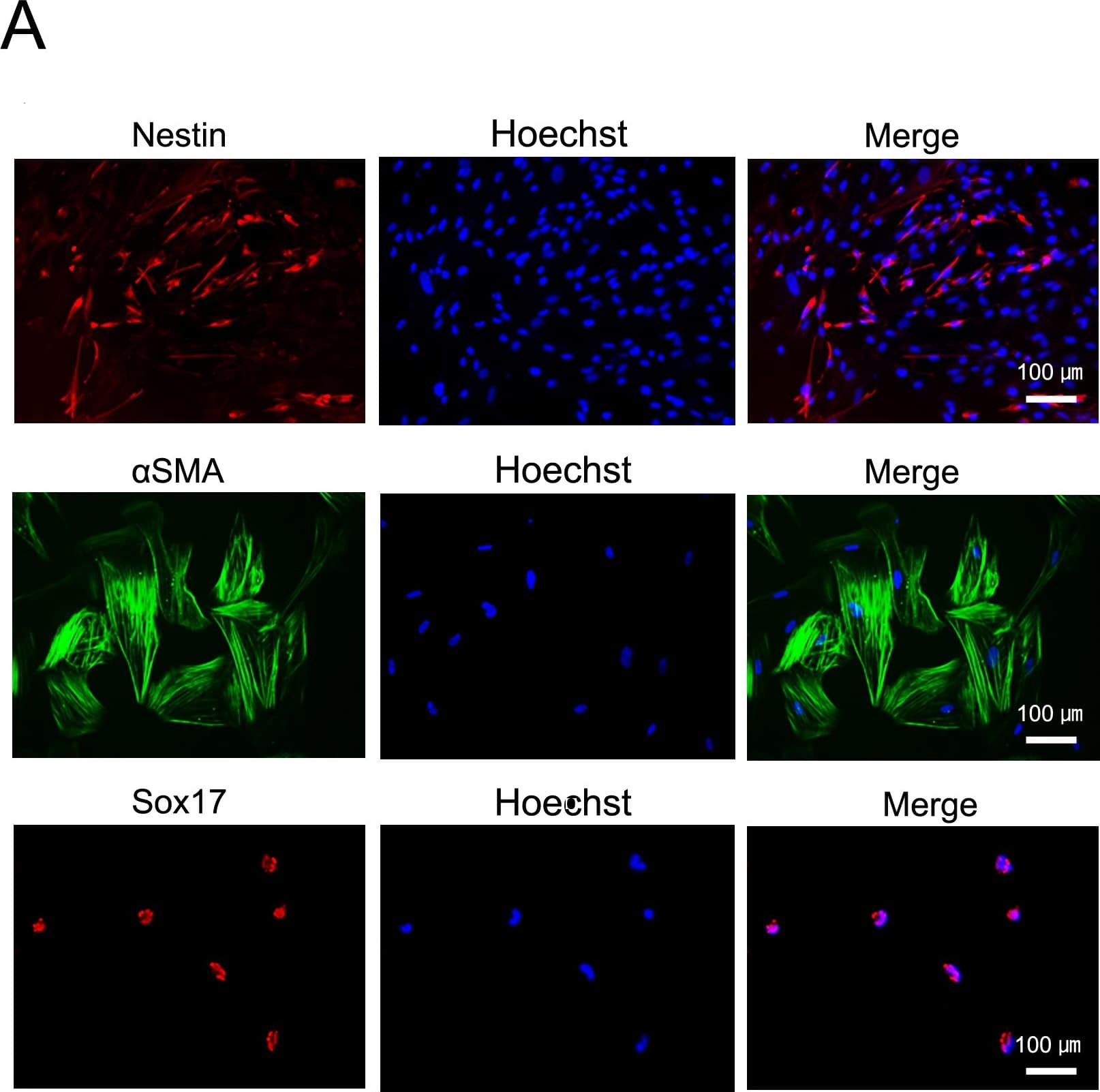 Detection of Human SOX17 by Immunocytochemistry/Immunofluorescence