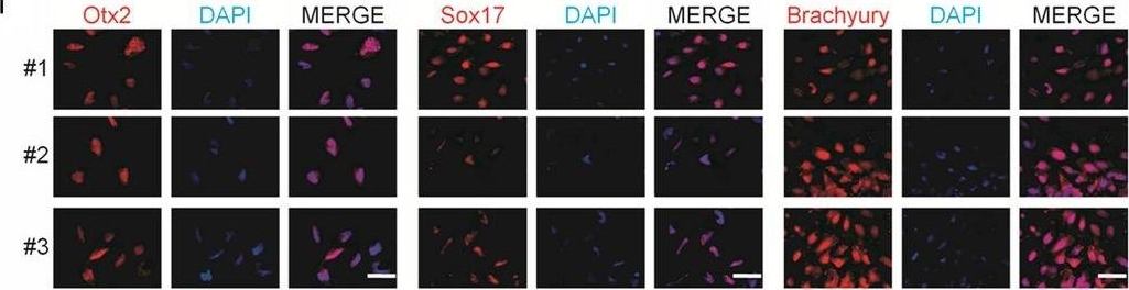 Detection of Human SOX17 by Immunocytochemistry/Immunofluorescence