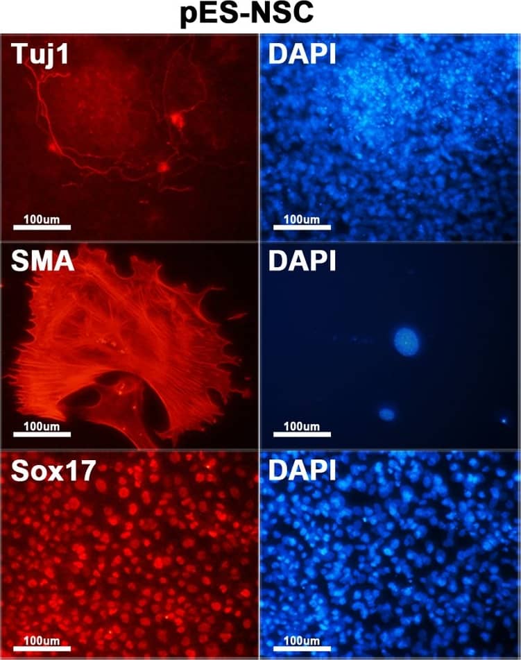 Detection of Mouse SOX17 by Immunocytochemistry/Immunofluorescence