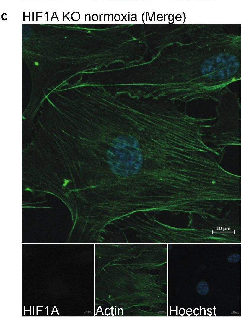 Detection of Human HIF-1 alpha/HIF1A by Immunocytochemistry/ Immunofluorescence