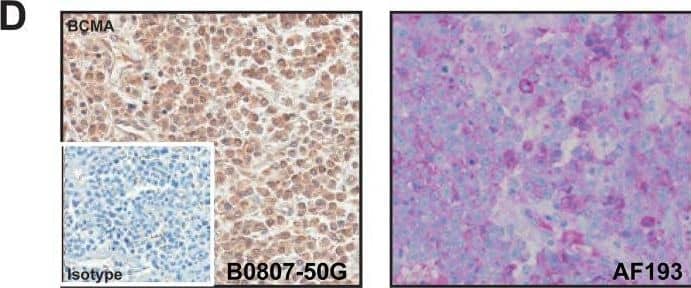Detection of BCMA/TNFRSF17 by Immunohistochemistry