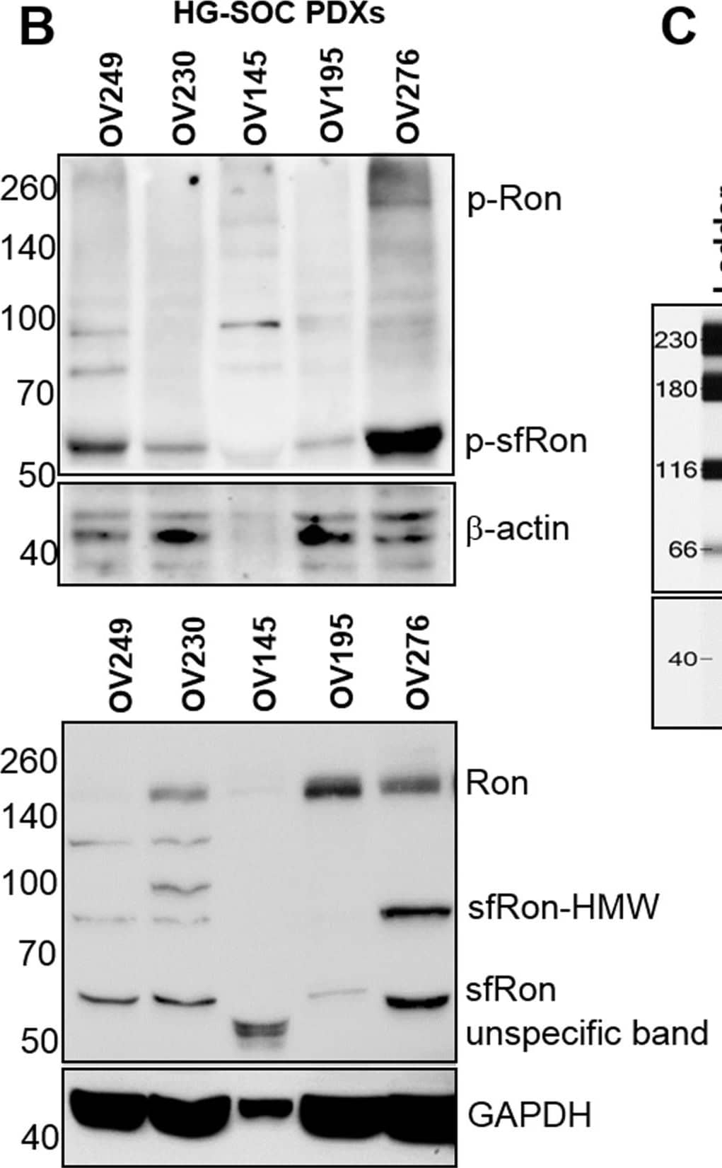 Detection of Human MSPR/Ron by Western Blot