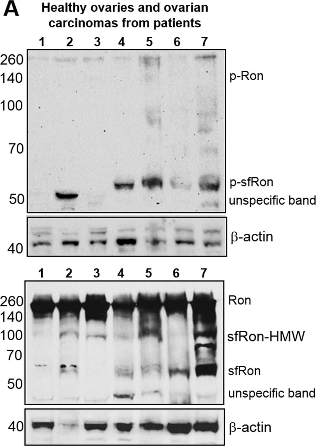 Detection of Human Human Phospho-MSPR/Ron (Y1238/Y1239) Antibody by Western Blot