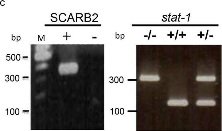 Detection of LIMPII/SR-B2 by Western Blot