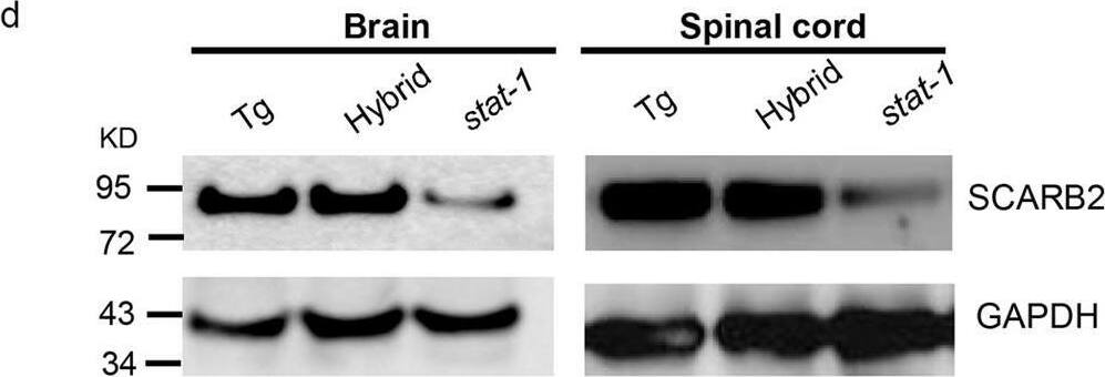 Detection of LIMPII/SR-B2 by Western Blot