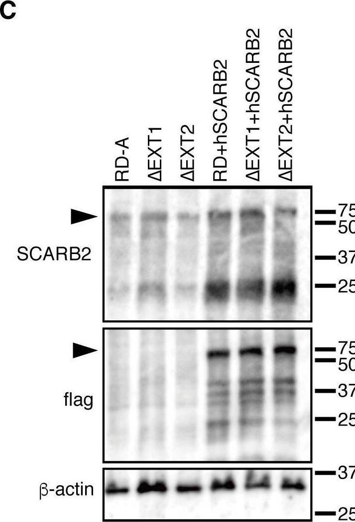 Detection of LIMPII/SR-B2 by Western Blot