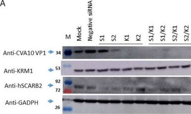 Detection of LIMPII/SR-B2 by Western Blot