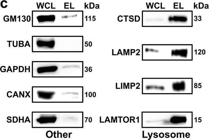 Detection of LIMPII/SR-B2 by Western Blot