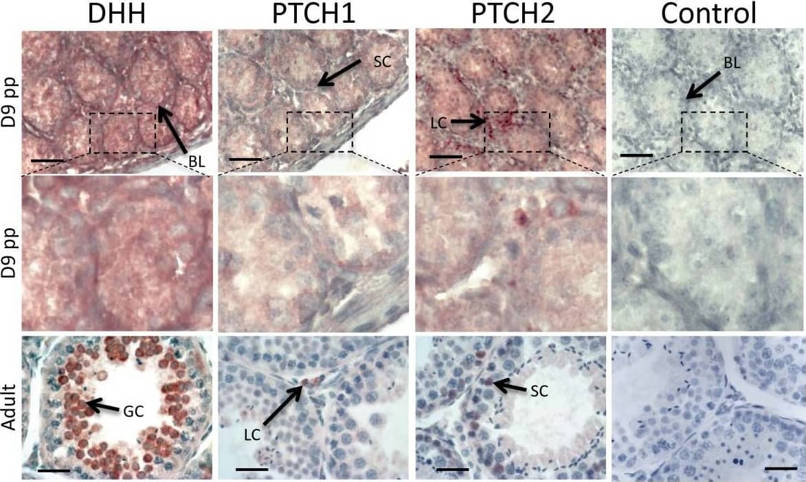 Detection of Marsupial Desert Hedgehog/Dhh by Immunohistochemistry