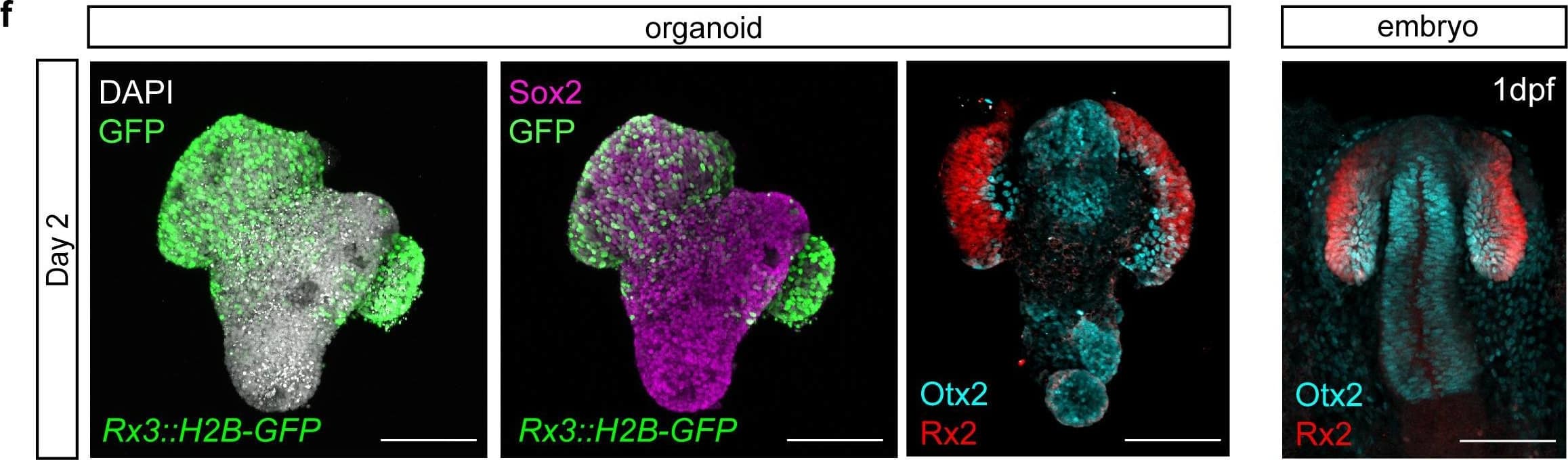 Detection of Zebrafish Otx2 by Immunohistochemistry