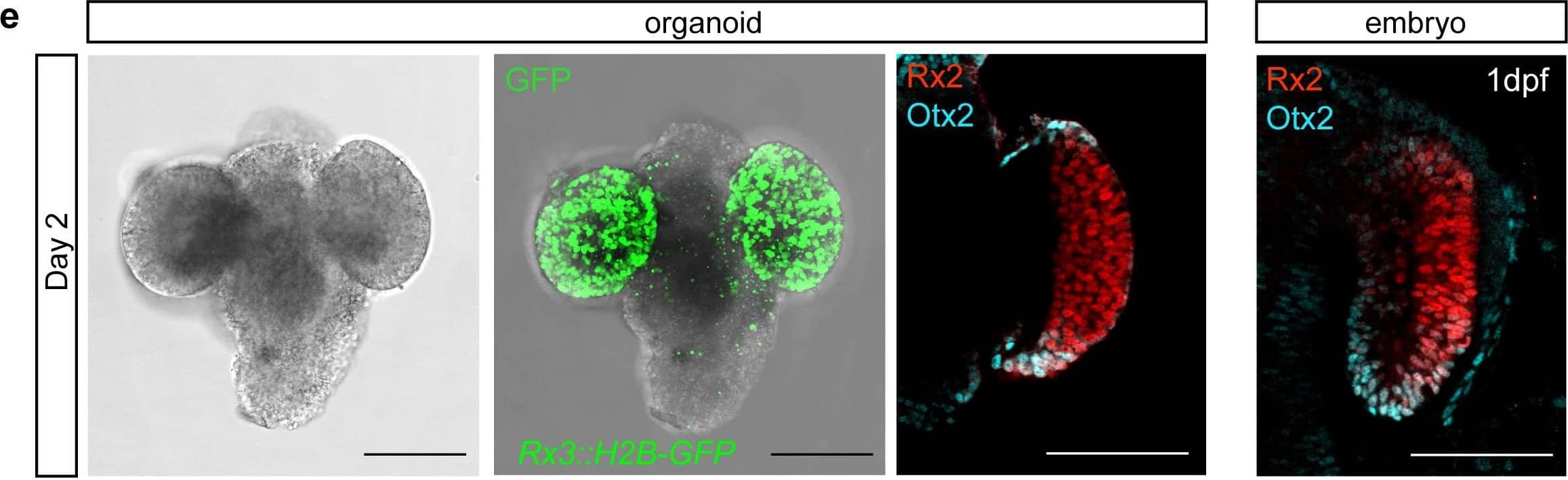 Detection of Zebrafish Otx2 by Immunohistochemistry