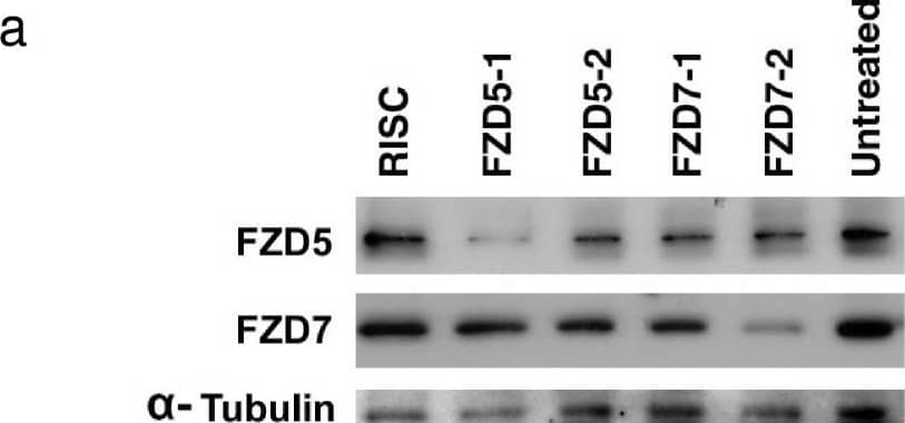 Detection of Frizzled-7 by Western Blot Detection of Frizzled-7 by Western Blot