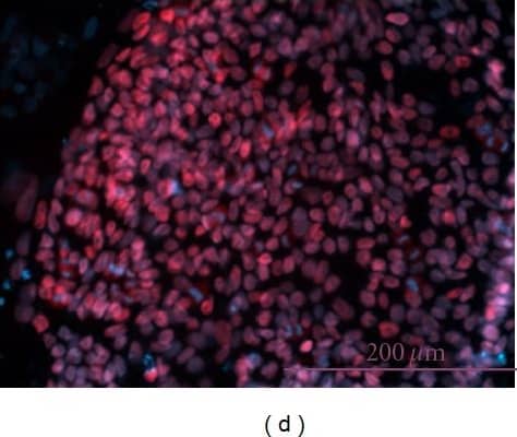 Detection of Human Nanog by Immunocytochemistry/Immunofluorescence