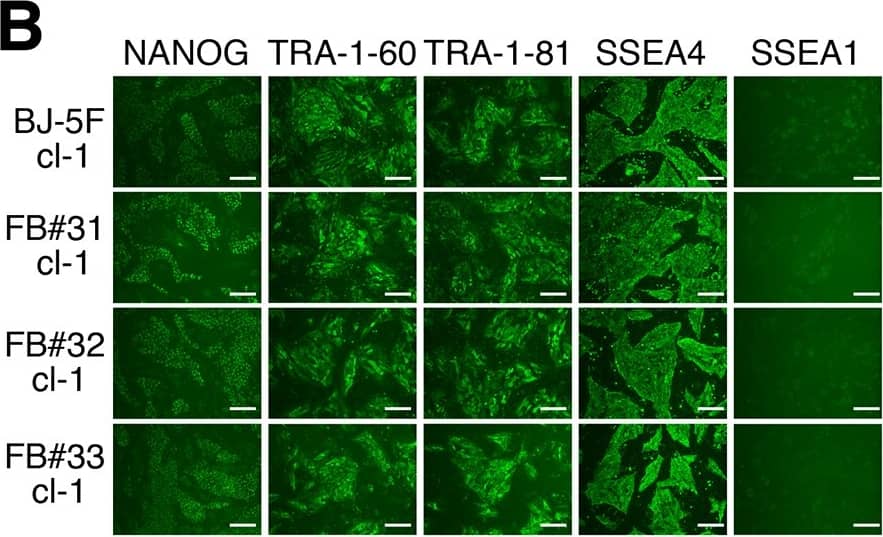 Detection of Human Nanog by Immunocytochemistry/Immunofluorescence