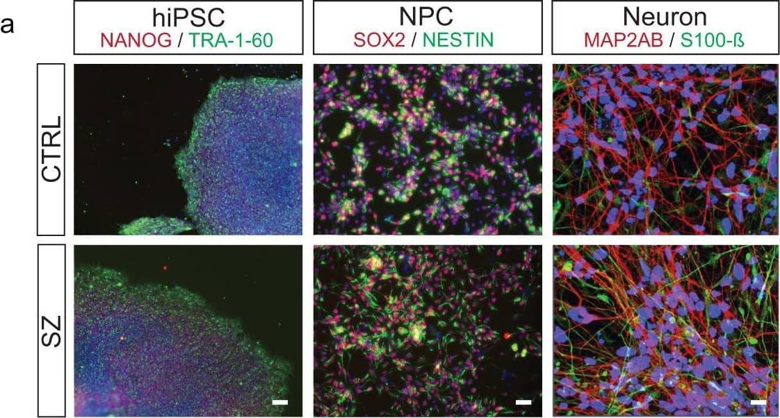 Detection of Human Nanog by Immunocytochemistry/ Immunofluorescence