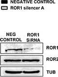 Detection of Human ROR1 by Knockdown Validated