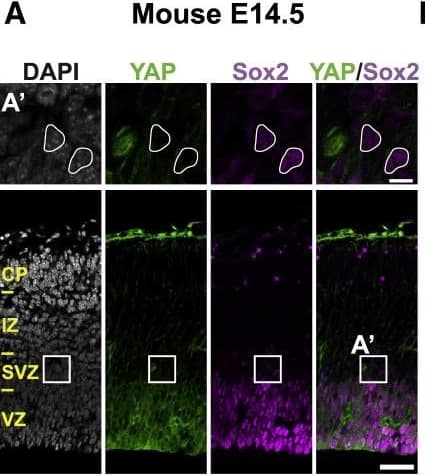 Detection of Human Human/Mouse/Rat SOX2 Antibody by Immunocytochemistry/ Immunofluorescence