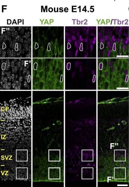 Detection of Mouse Human/Mouse/Rat SOX2 Antibody by Immunocytochemistry/ Immunofluorescence