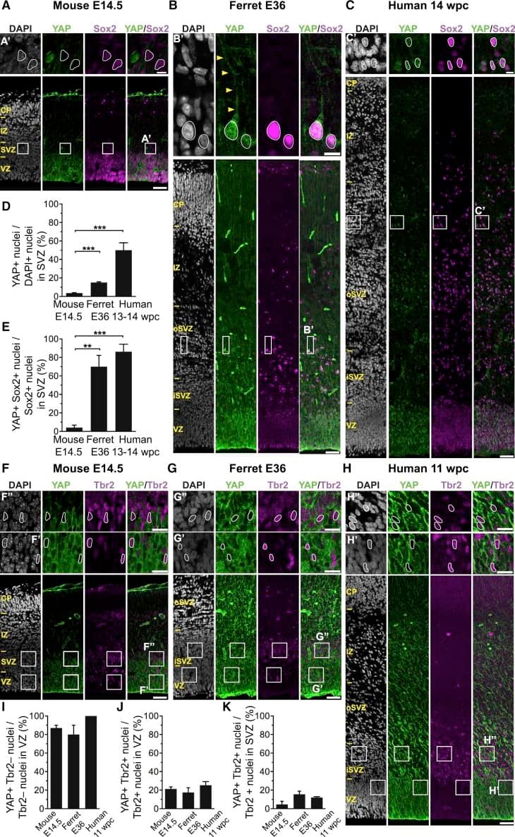 Detection of Human Human/Mouse/Rat SOX2 Antibody by Immunocytochemistry/ Immunofluorescence