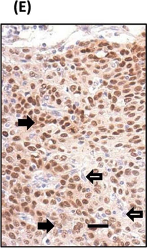 Detection of Human SOX2 by Immunohistochemistry