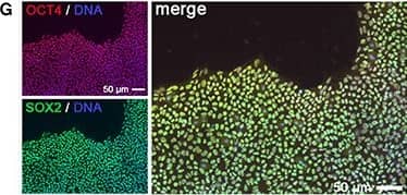 Detection of Human SOX2 by Immunocytochemistry/Immunofluorescence