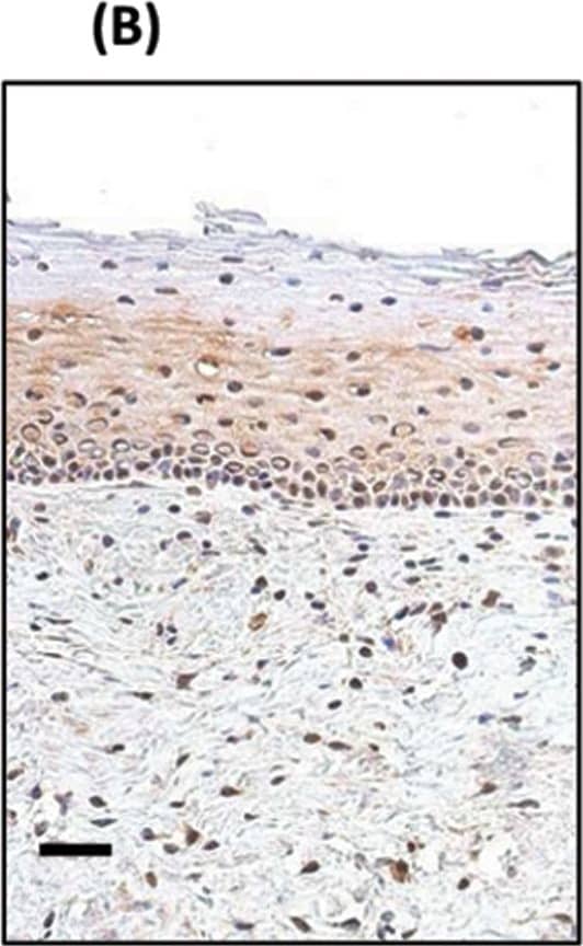 Detection of Human SOX2 by Immunohistochemistry