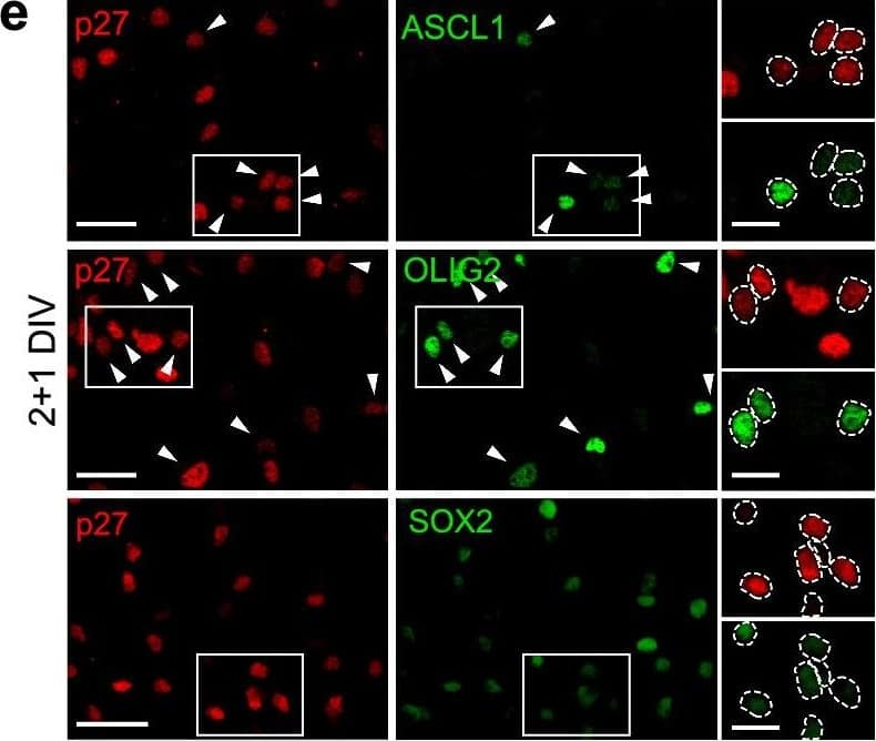 Detection of Mouse SOX2 by Immunocytochemistry/ Immunofluorescence
