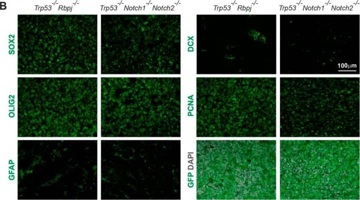 Detection of Mouse SOX2 by Immunohistochemistry
