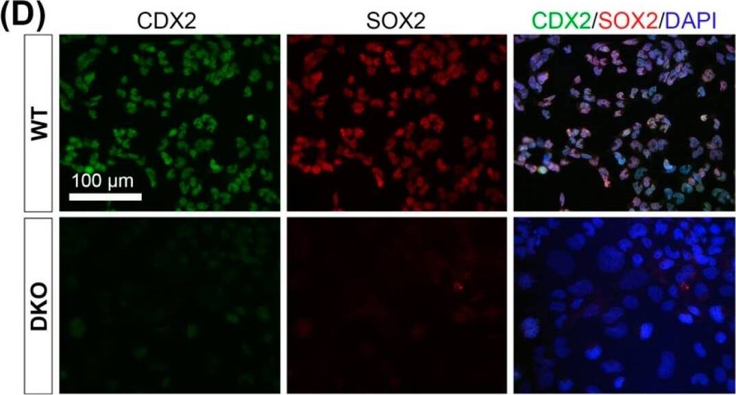 Detection of Mouse SOX2 by Immunocytochemistry/ Immunofluorescence