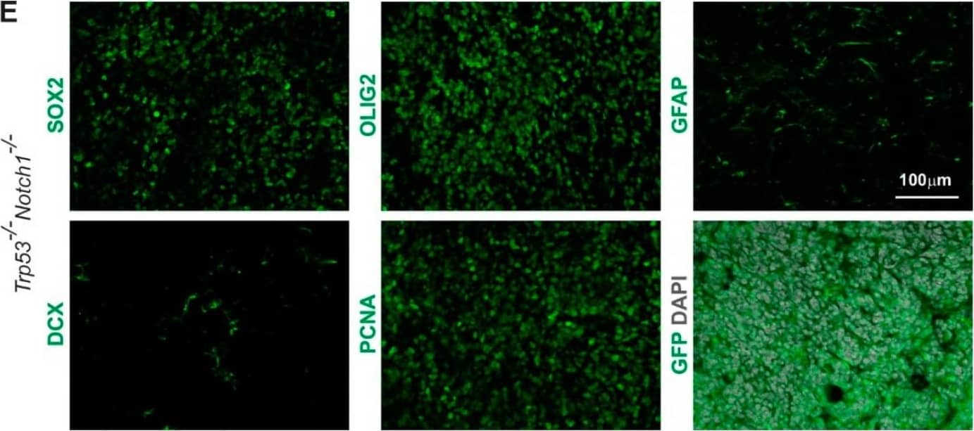 Detection of Mouse SOX2 by Immunohistochemistry