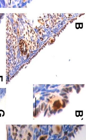 Detection of Mouse VASA by Immunohistochemistry