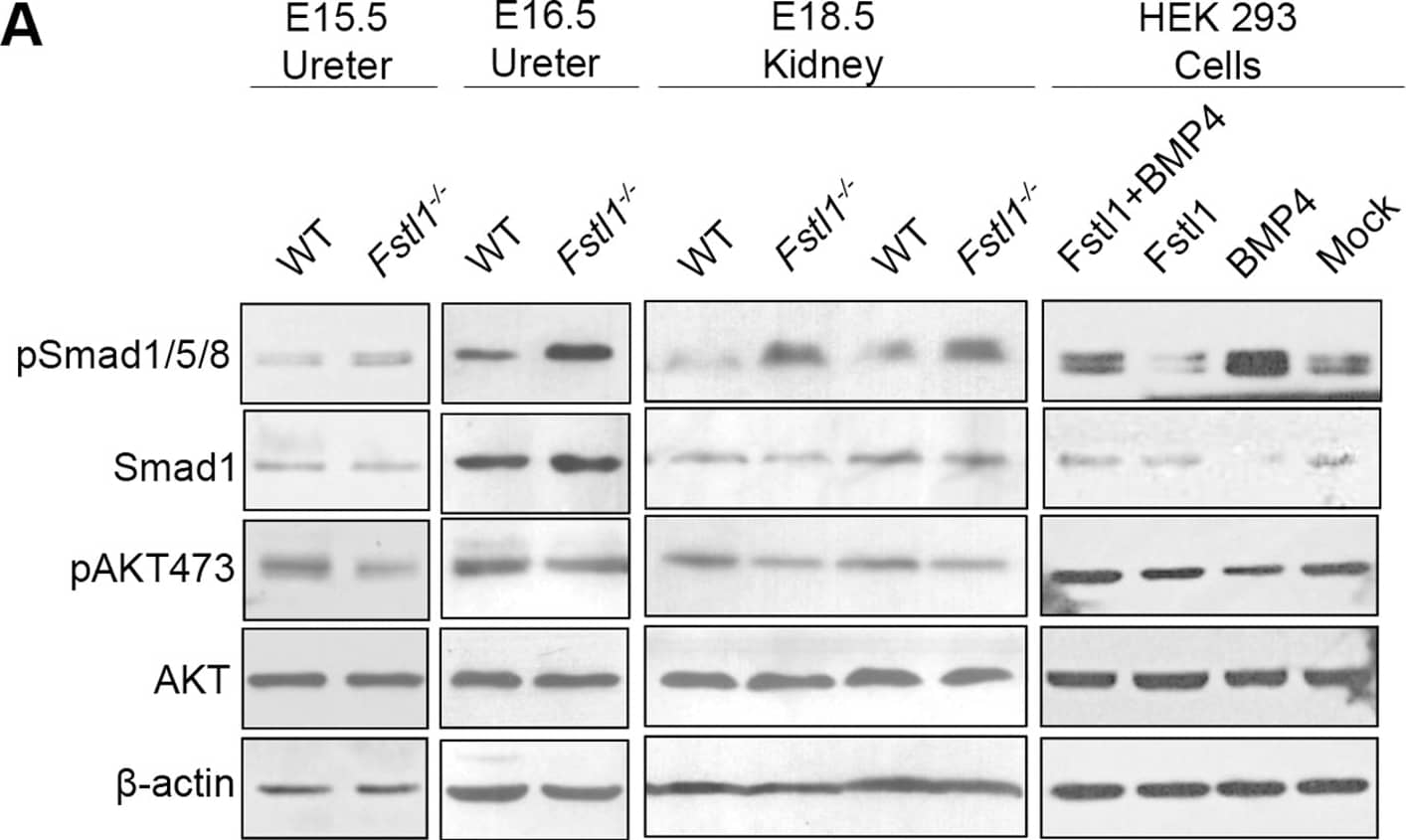 Detection of Mouse Smad1 by Western Blot