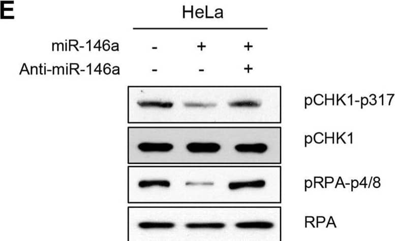 Detection of Phospho-Chk1 (S317) by Western Blot
