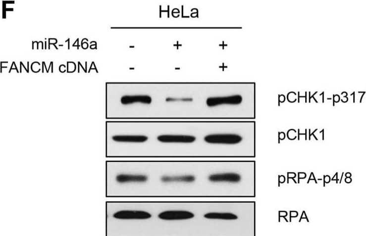 Detection of Phospho-Chk1 (S317) by Western Blot