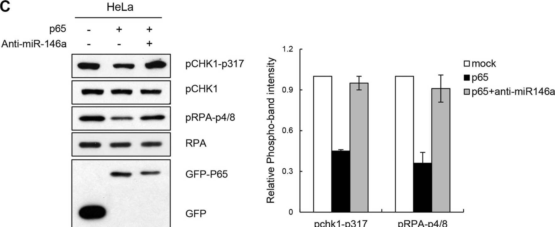 Detection of Phospho-Chk1 (S317) by Western Blot