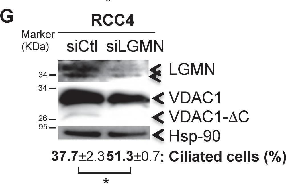 Detection of Legumain/Asparaginyl Endopeptidase by Western Blot