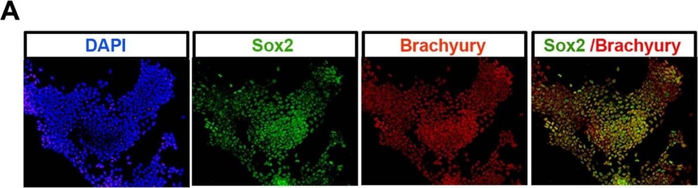 Detection of Mouse Brachyury by Immunocytochemistry/ Immunofluorescence