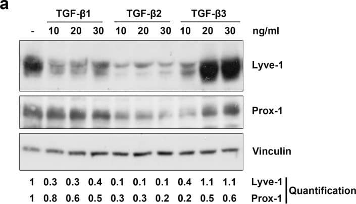Detection of Human LYVE-1 by Western Blot