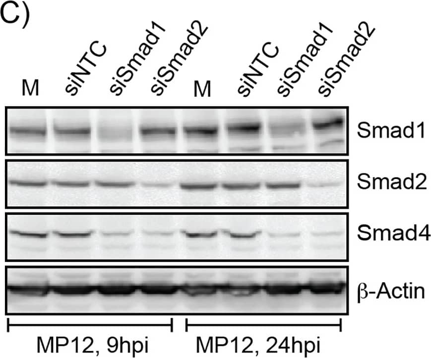 Detection of Human Smad4 by Western Blot