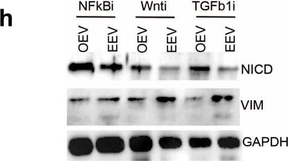 Detection of Human Vimentin by Western Blot