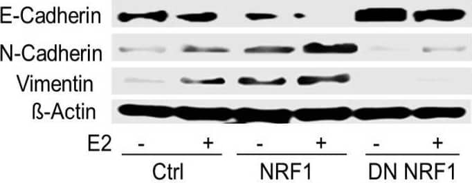 Detection of Human Vimentin by Western Blot