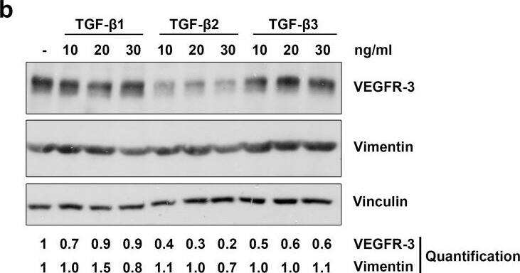 Detection of Human Vimentin by Western Blot