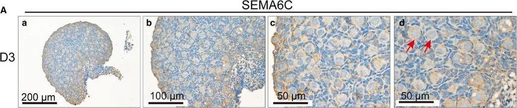 Detection of Semaphorin 6C by Immunohistochemistry
